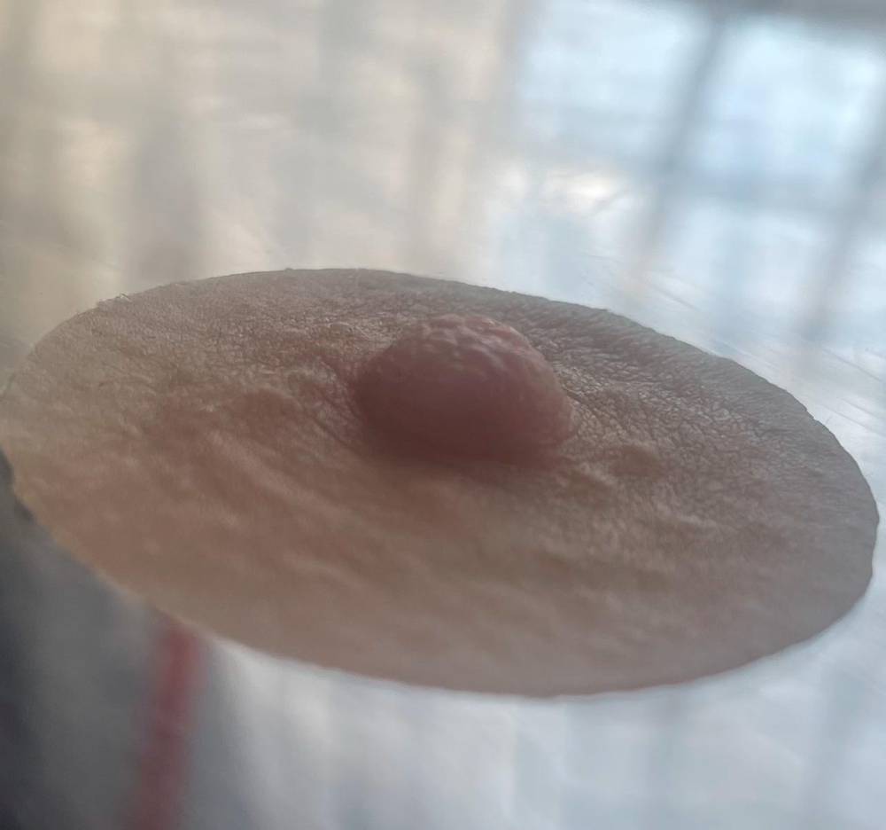 Prothèse aréolaire en silicone